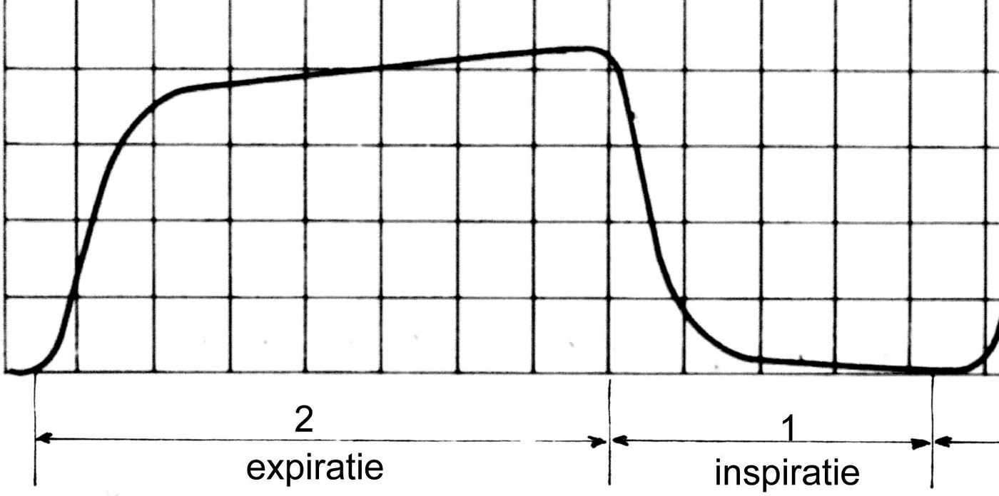 A square capnography waveform with a sharp rise, a plateau, and a sharp drop back to the baseline.