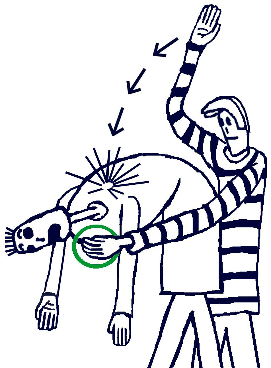 Back blows land between the shoulder blades while the person leans forward. The circled hand is bracing the chest.